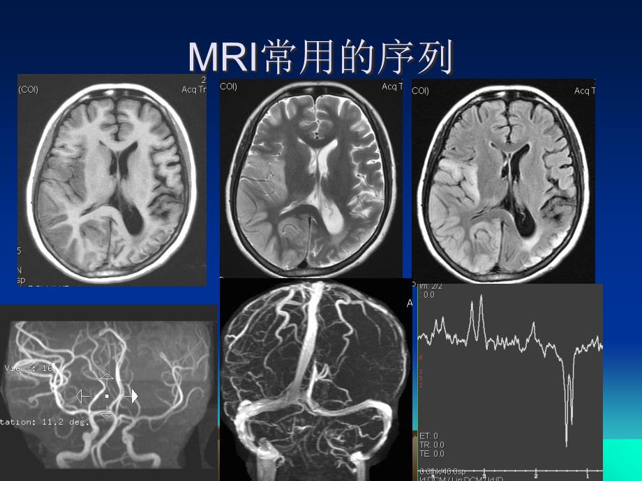 头颅MRI断层解剖_第2页