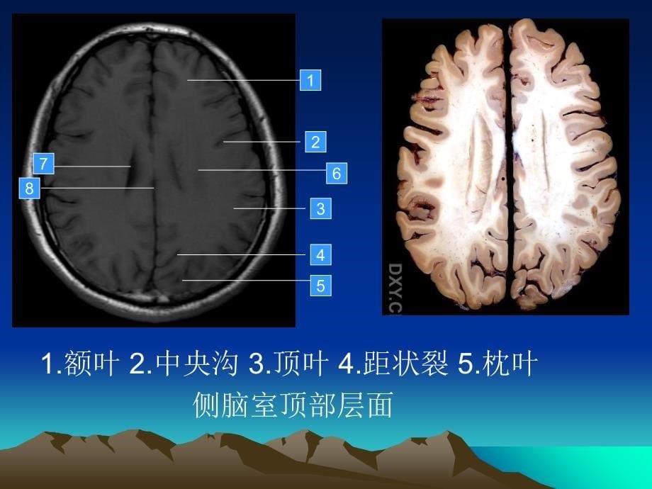 头颅MRI断层解剖_第5页