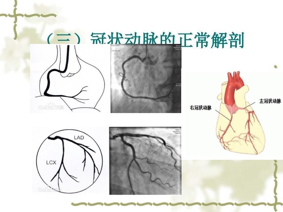 DSA介入术与护理配合_第5页