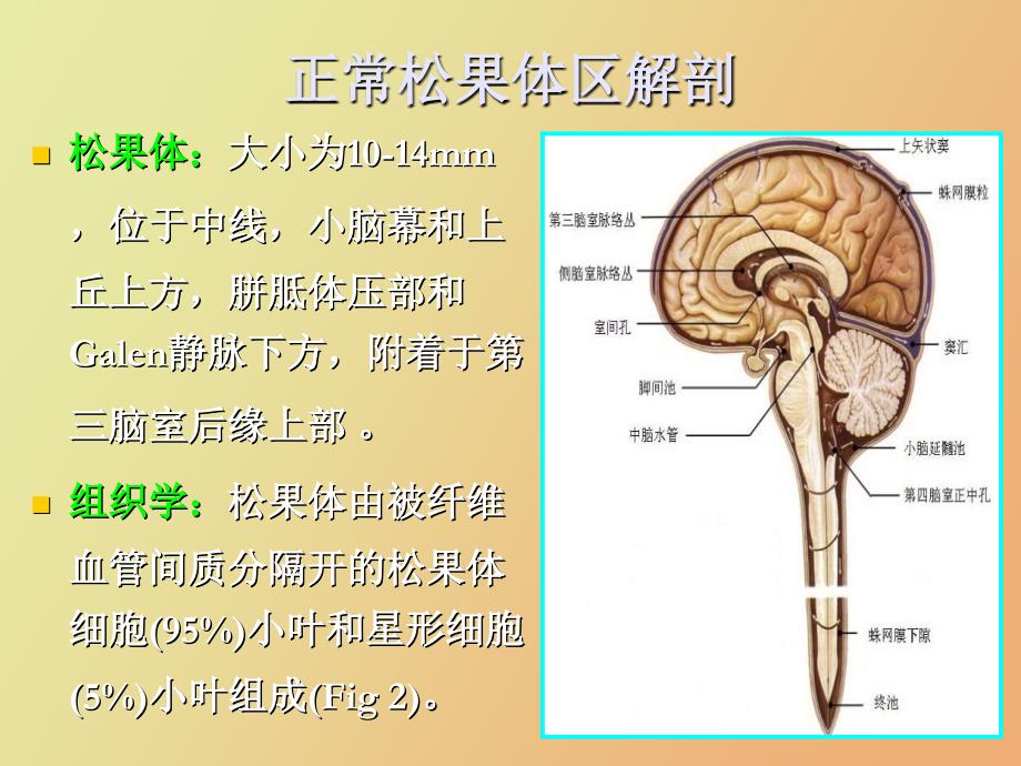 松果体区病变影像诊断_第2页