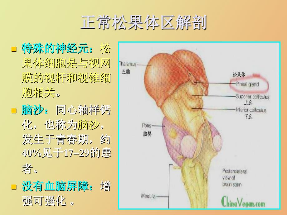 松果体区病变影像诊断_第3页