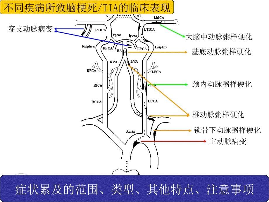 缺血性卒中的诊断课件_第5页