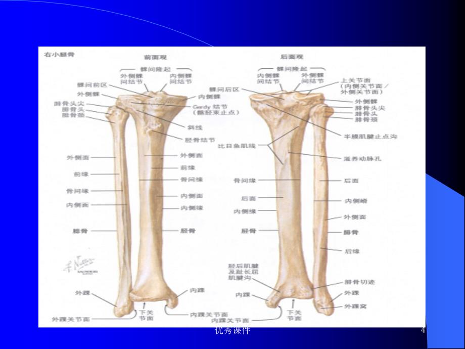 胫腓骨骨折【医疗资料】_第4页