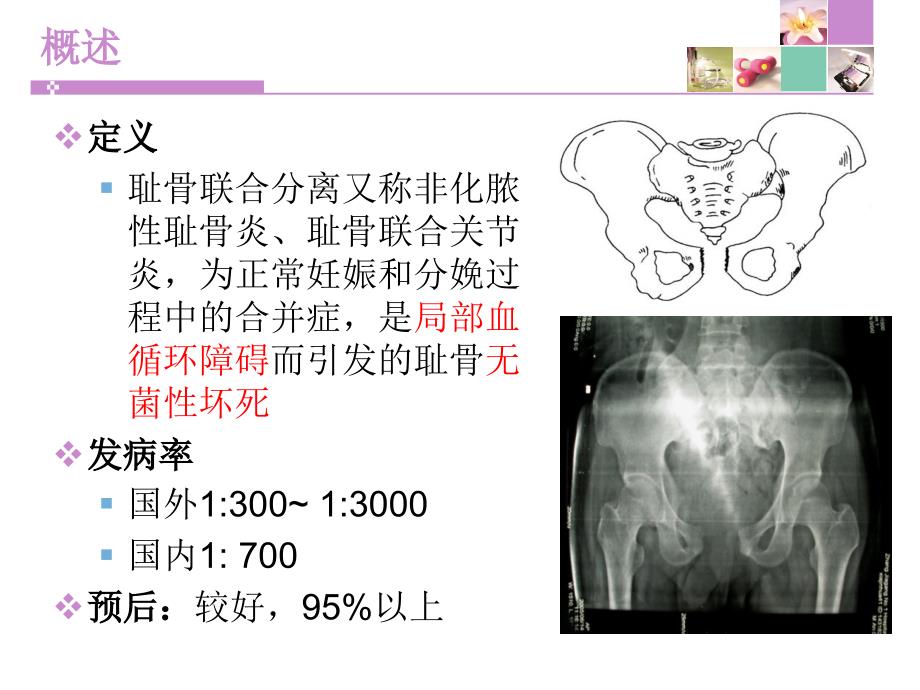 产科耻骨联合分离文档资料_第3页