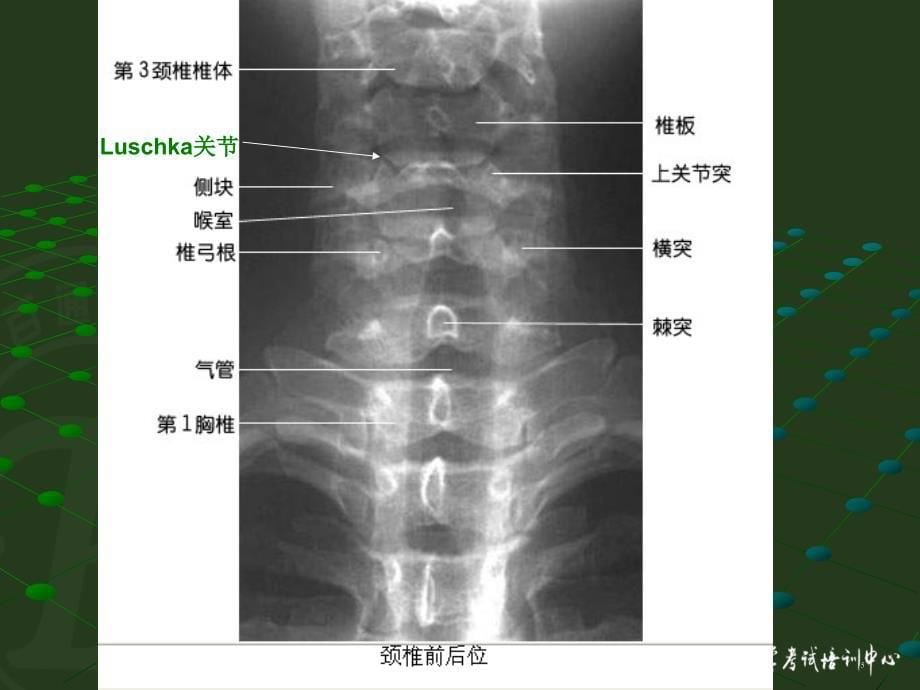 影像解剖2ppt课件_第5页