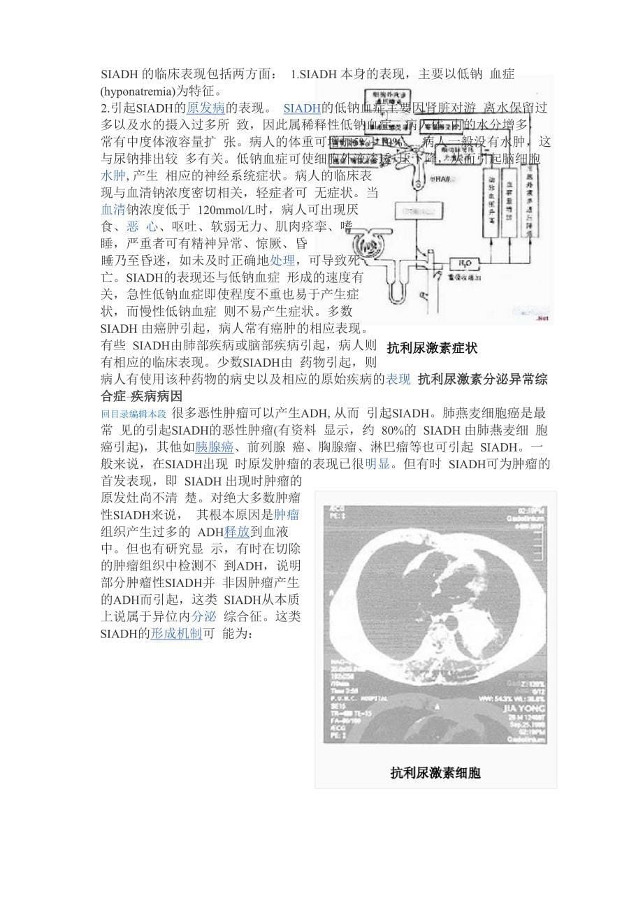 抗利尿激素异常分泌综合症SIADH_第5页