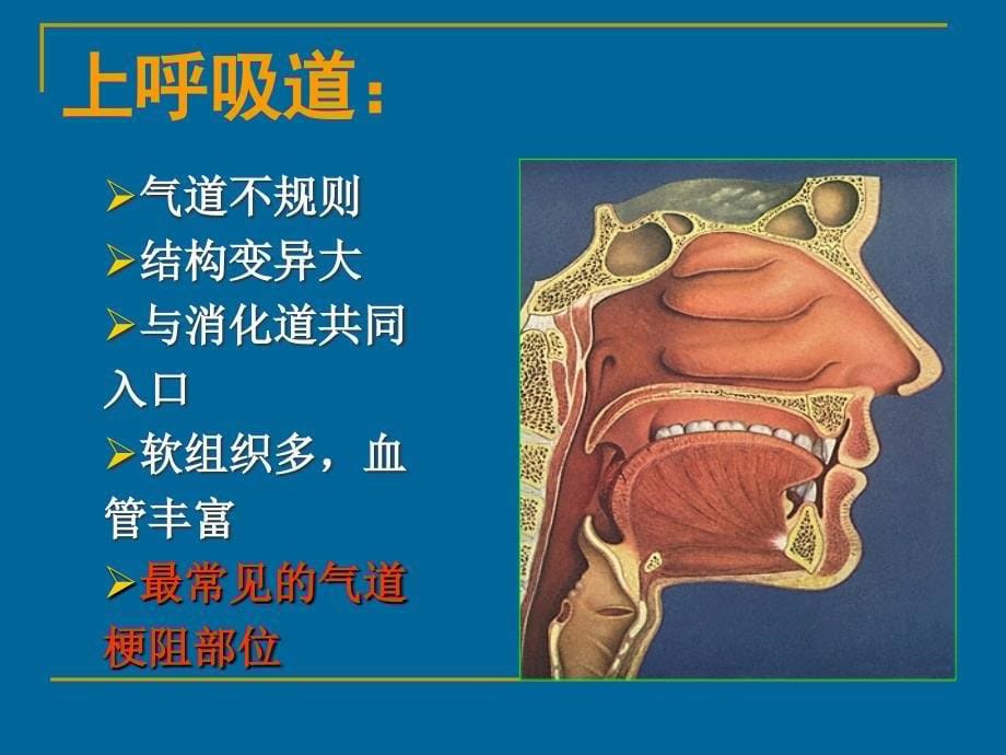 人工气道的建立与维护_第5页