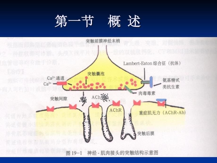 肌肉疾病诊治_第5页