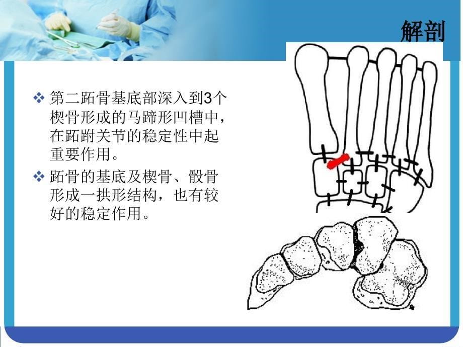 lisfranc损伤ppt课件精选文档_第5页