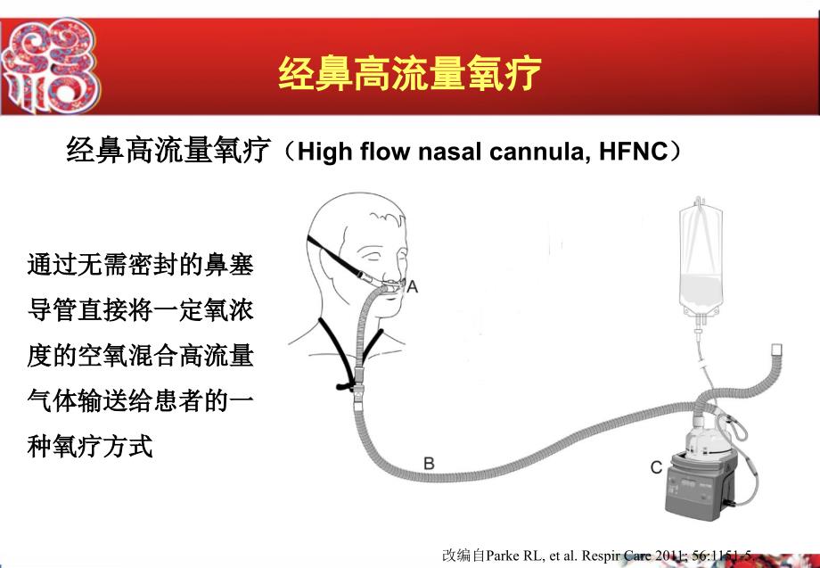 经鼻高流量氧疗vs无创正压通气.ppt_第2页
