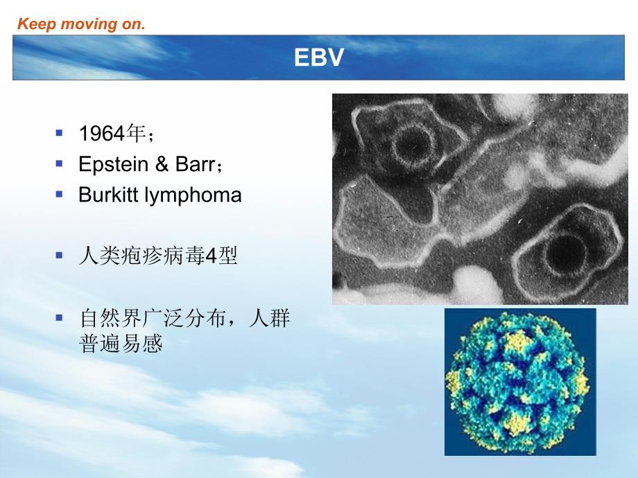 EBV及传染性单核细胞增多症课件_第3页