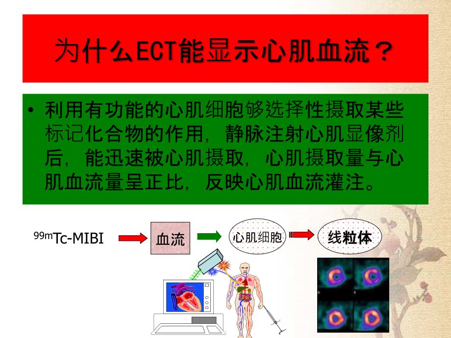 第八章心血管系统剖析_第4页