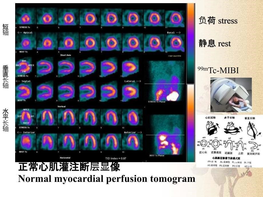 第八章心血管系统剖析_第5页