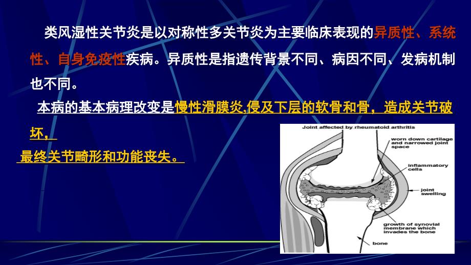 类风湿性关节炎讲解演示课件内科学课件类风湿性关节炎_第2页