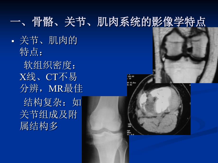 骨关节、肌肉上系统影像学诊断ppt课件_第3页