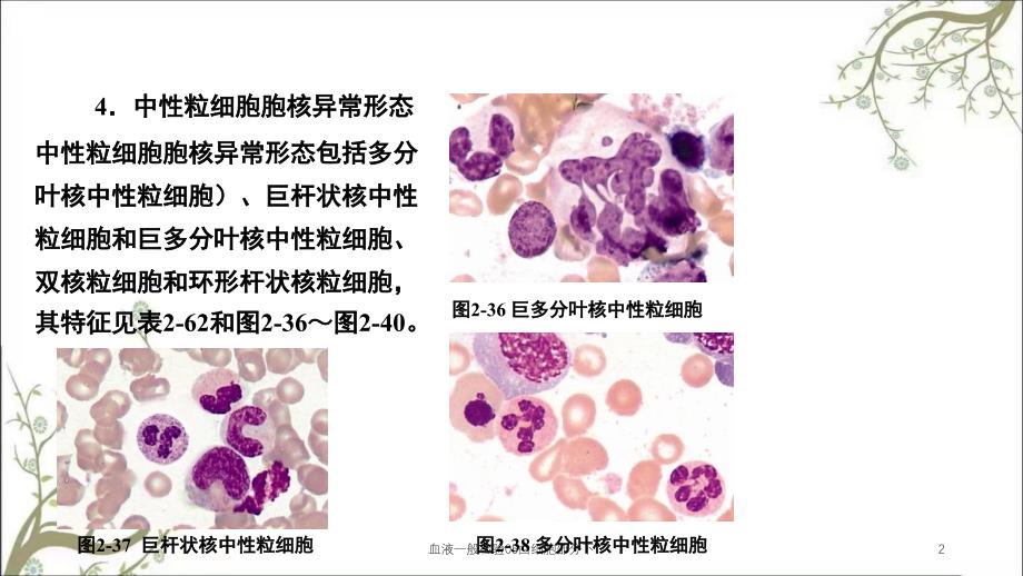 血液一般检验05白细胞部分下课件_第2页