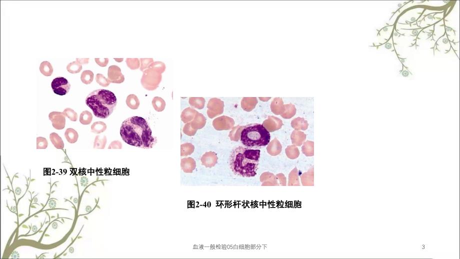 血液一般检验05白细胞部分下课件_第3页