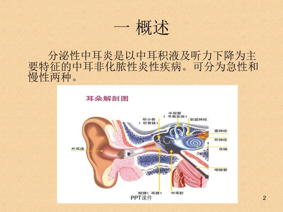 分泌性中耳炎的护理--ppt课件_第2页