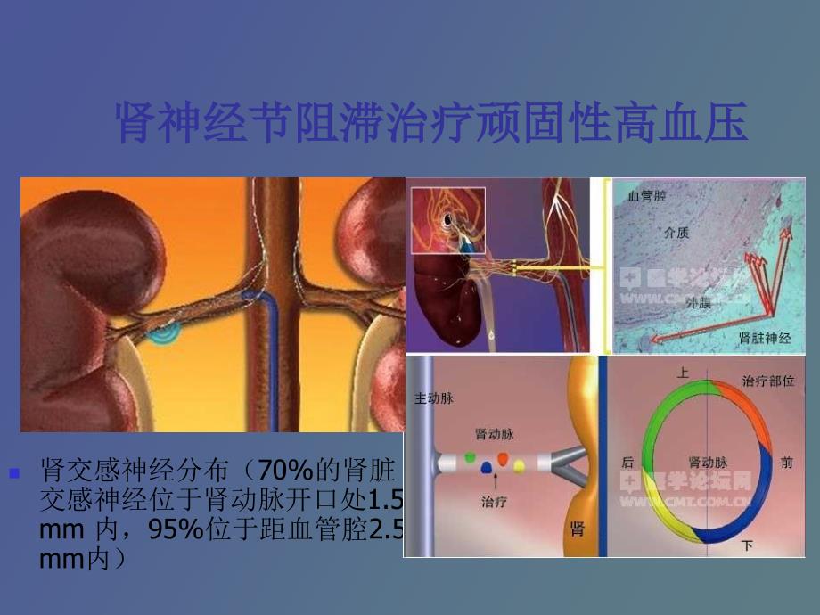 不常用的心脏介入治疗_第4页