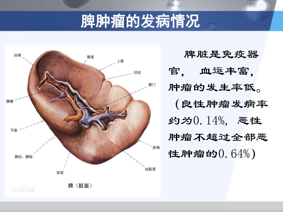 脾脏肿瘤的影像诊断ppt课件_第3页