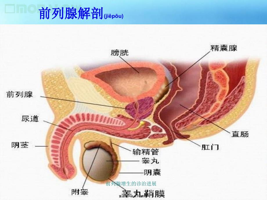 前列腺增生的诊治进展课件_第3页