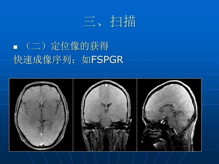 《头部MR成像技术》PPT课件_第5页