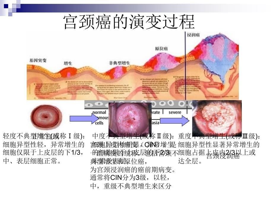 宫颈癌防治PPT_第5页