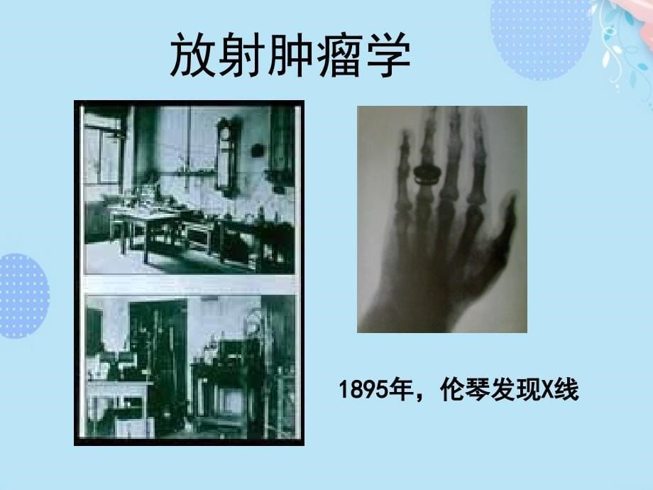 医学图像在放疗中的应用PPT资料(完整版)课件_第5页