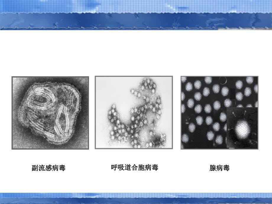 急性慢性支气管炎_第5页