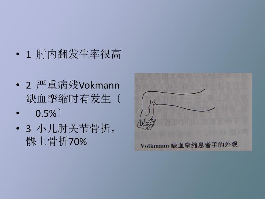 课件小儿肱骨髁上骨折_第4页