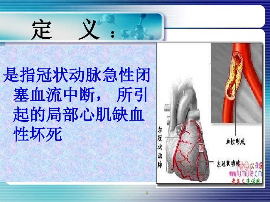 急性心肌梗死急救护理PPT参考课件_第4页