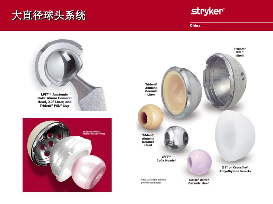 Stryker大直径球头系统产品介绍_第2页