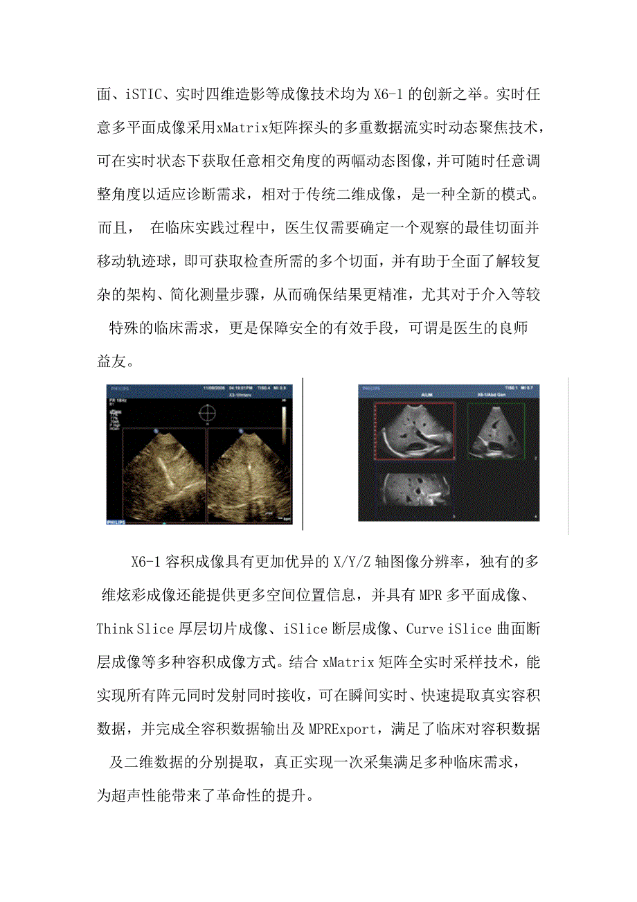 飞利浦G4 xMATRIX iU22开创超声医学新纪元.doc_第3页