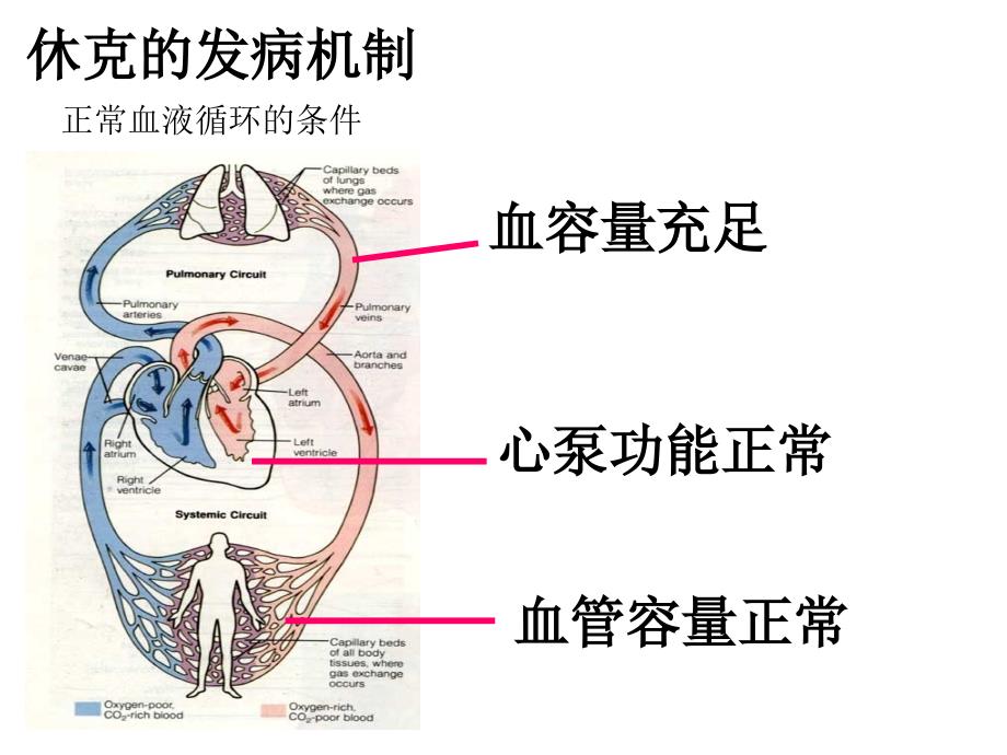 休克的病因和分类PPT课件_第4页