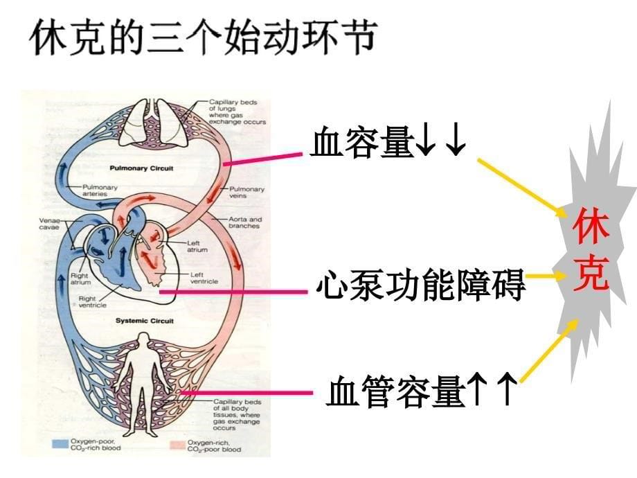 休克的病因和分类PPT课件_第5页