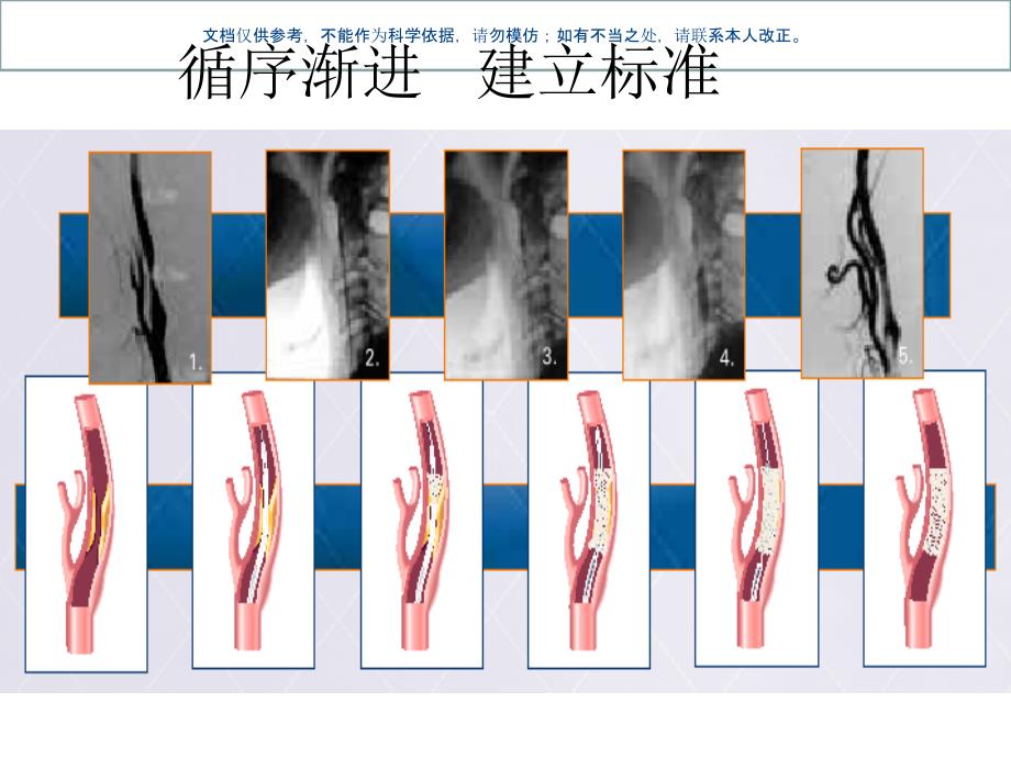 颈动脉支架手术步ppt课件_第1页