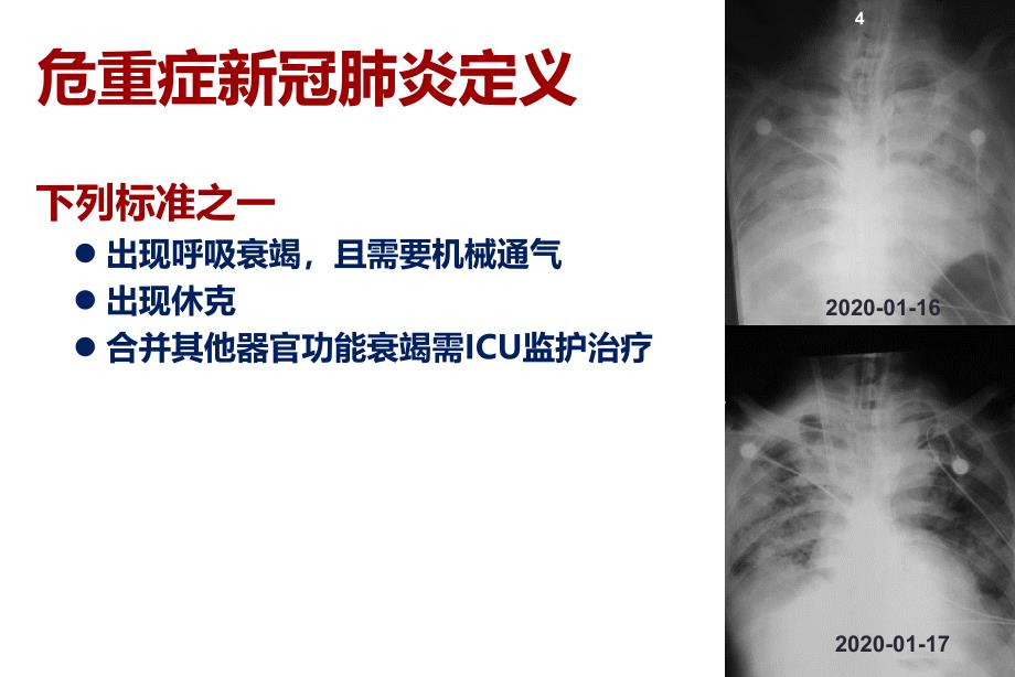 危重症新冠肺炎的临床管理PPT精选文档_第4页