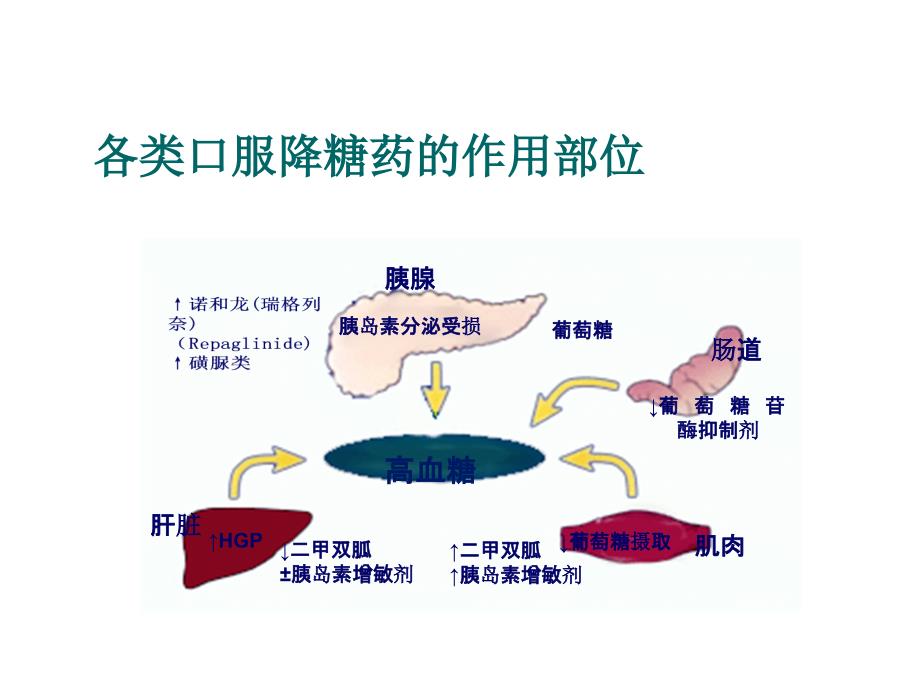 糖尿病临床常用药物（79页精品课件PPT）_第4页