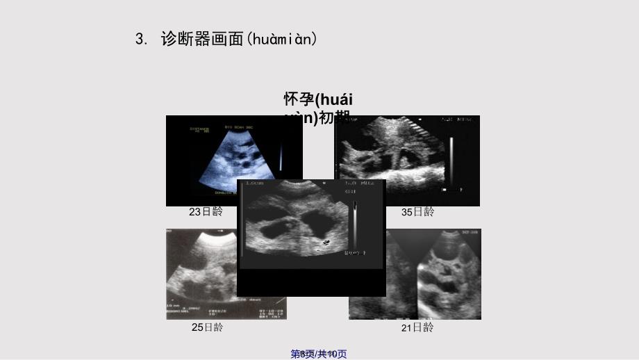 B超测定议影像怀孕诊断器使用及活用实用教案_第3页