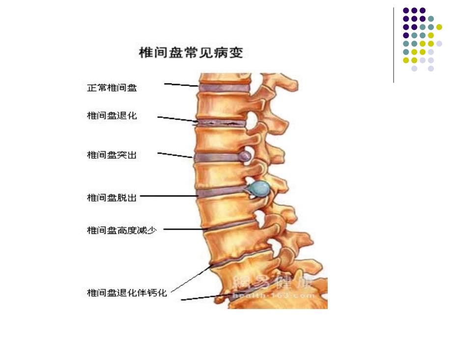 颈椎病围手术期的护理_第5页