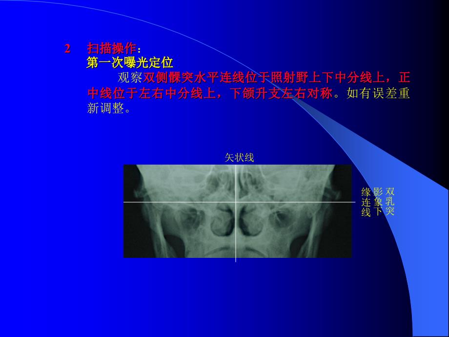 牙颌专用CT颞颌关节成像技术课件_第4页