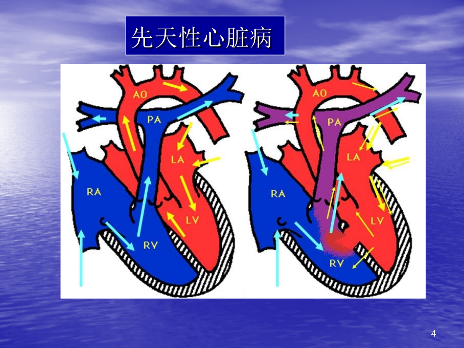 儿童护理ppt课件_第4页