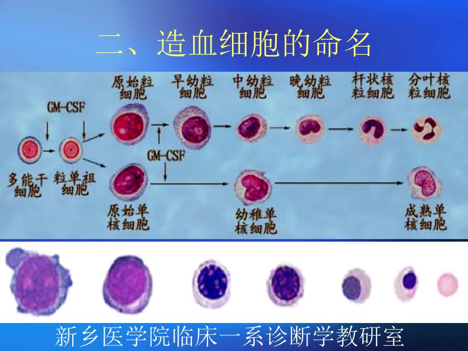 骨髓造血细胞形态学检查贺_第4页