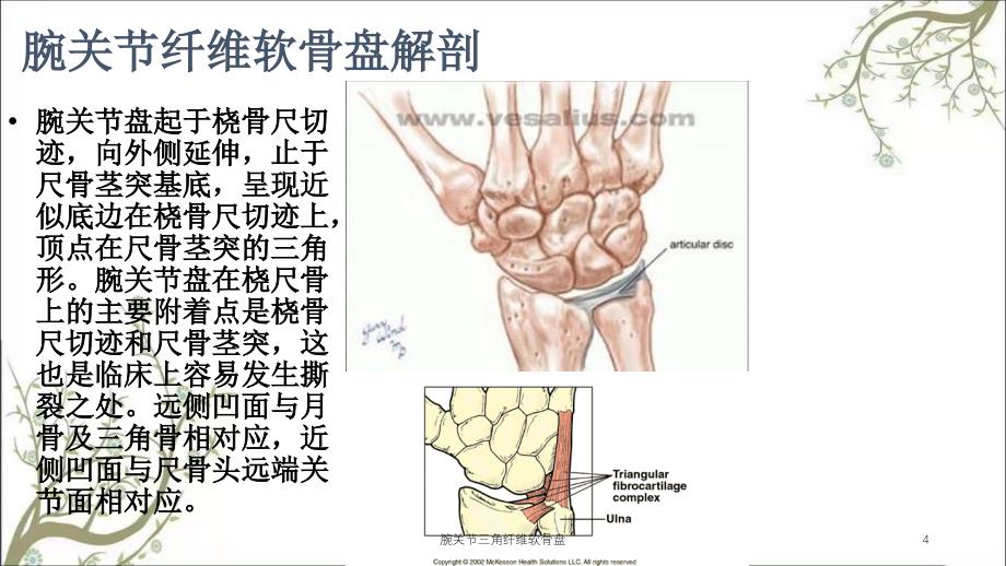 腕关节三角纤维软骨盘课件_第4页