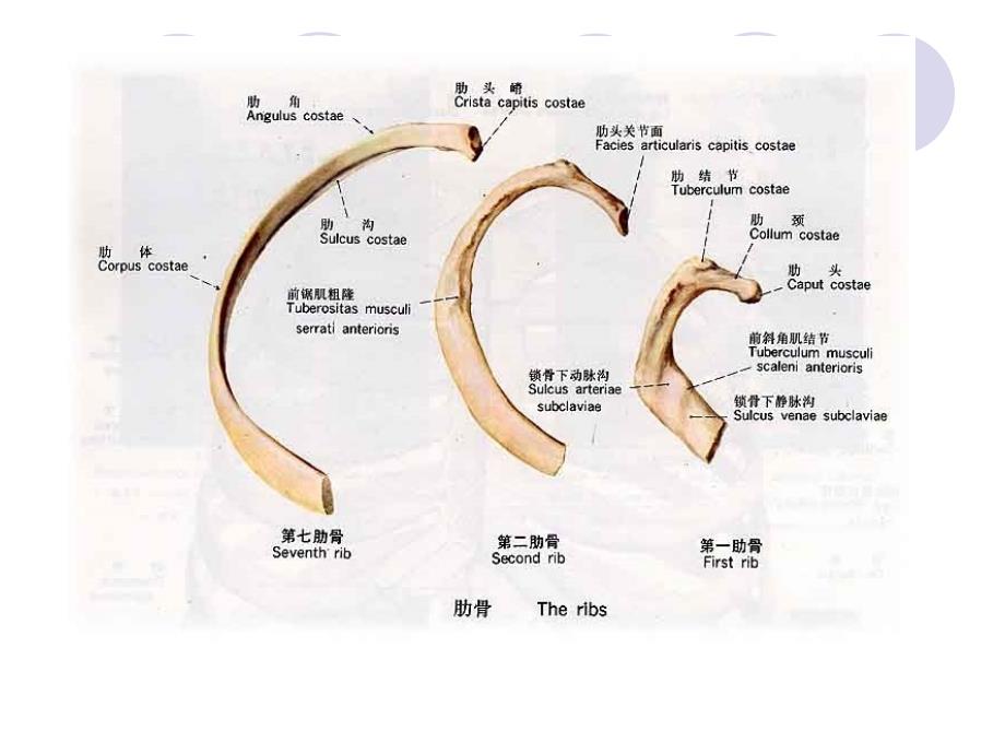 肋骨骨折ppt课件_第4页