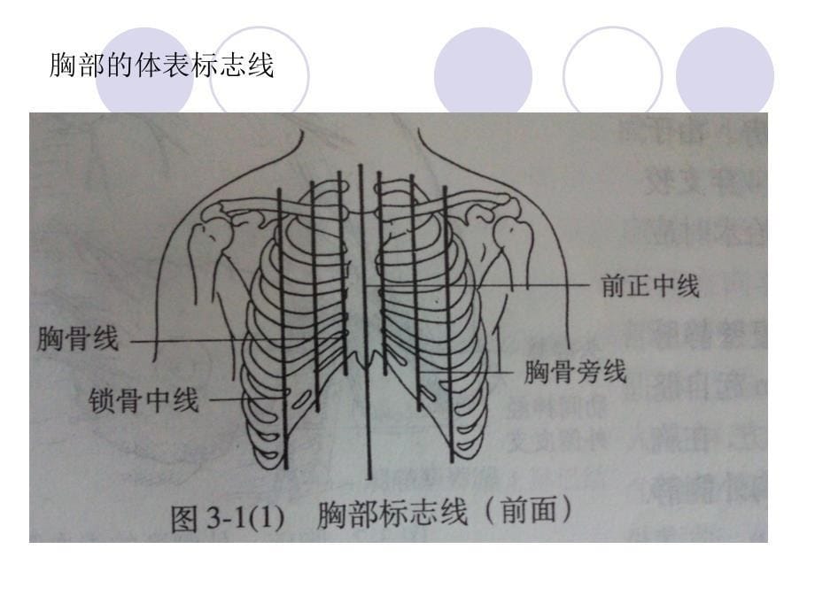 肋骨骨折ppt课件_第5页