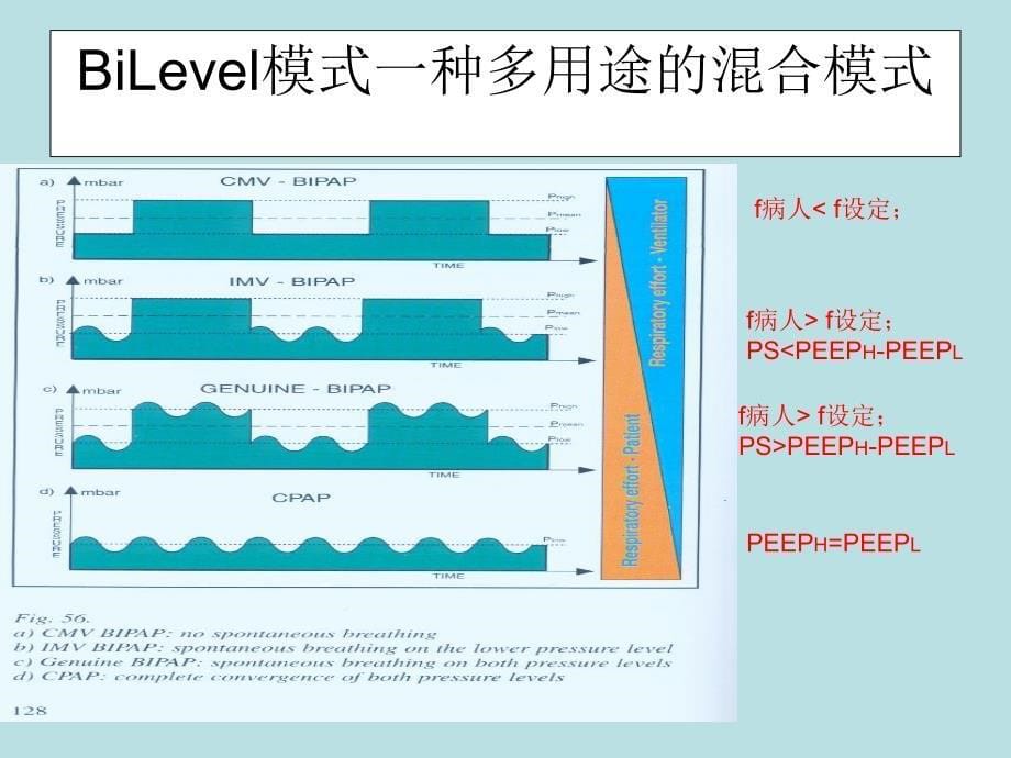 BiLevel双水平通气模式简介ppt课件_第5页