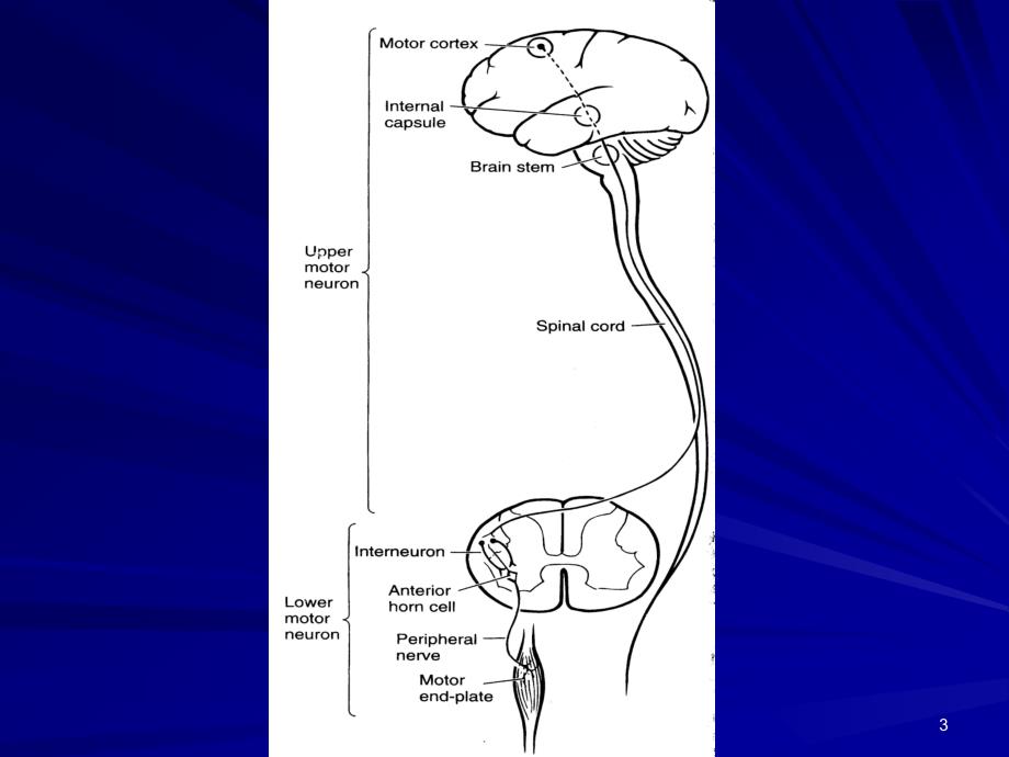 运动神经元疾病ppt课件_第3页