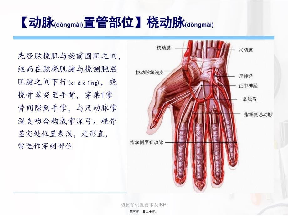 动脉穿刺置管术及IBP课件_第5页