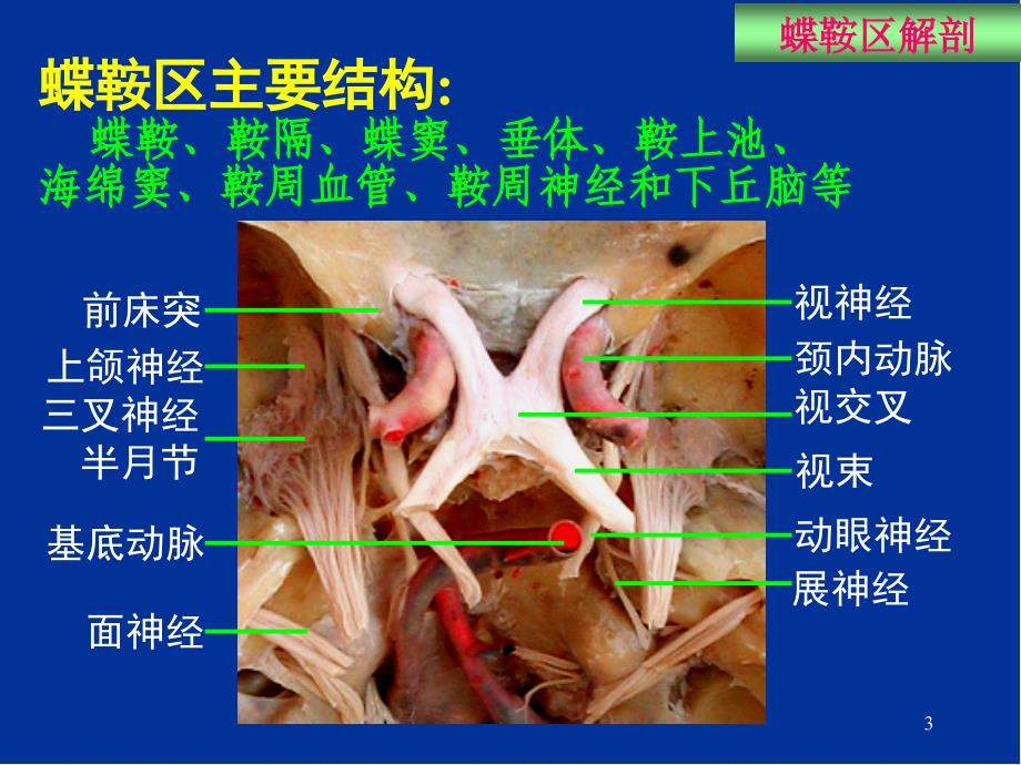 蝶鞍区断层解剖与影像对照PPT演示课件_第3页